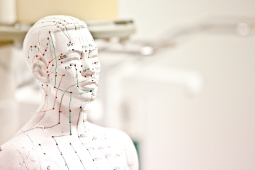 acupuncture